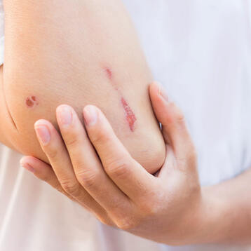 Notfallversorgung akute Verletzungen